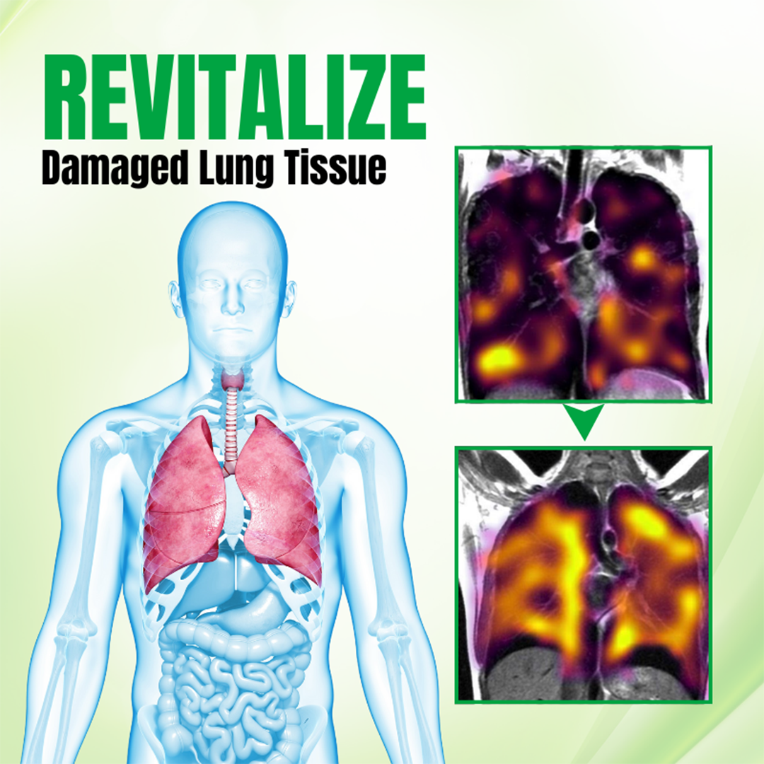 Biancat® RespiPure Herbal Lung Detox Spray 👍